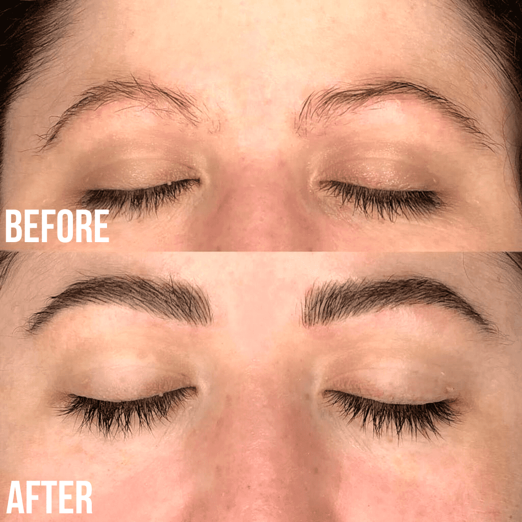 brow lift and tint before and after