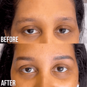 brow lift and tint before and after