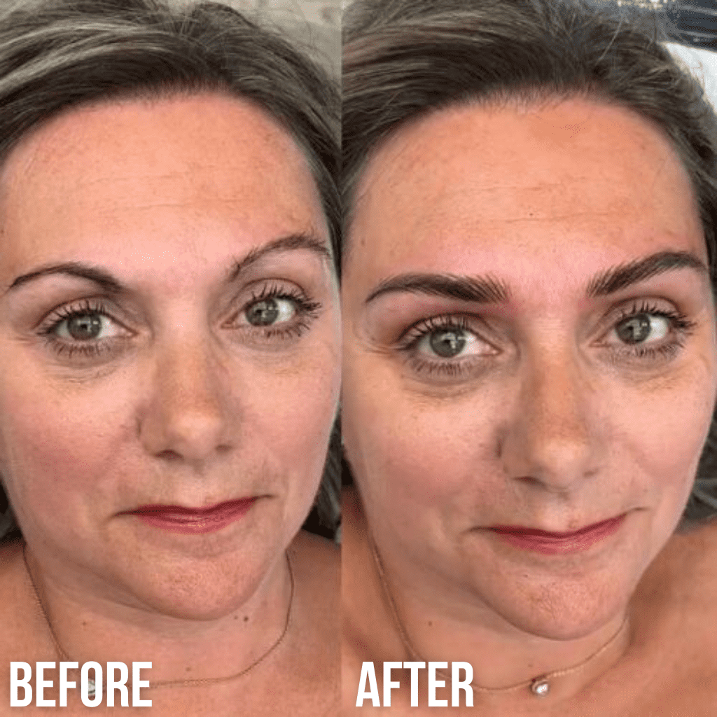 brow lift and tint