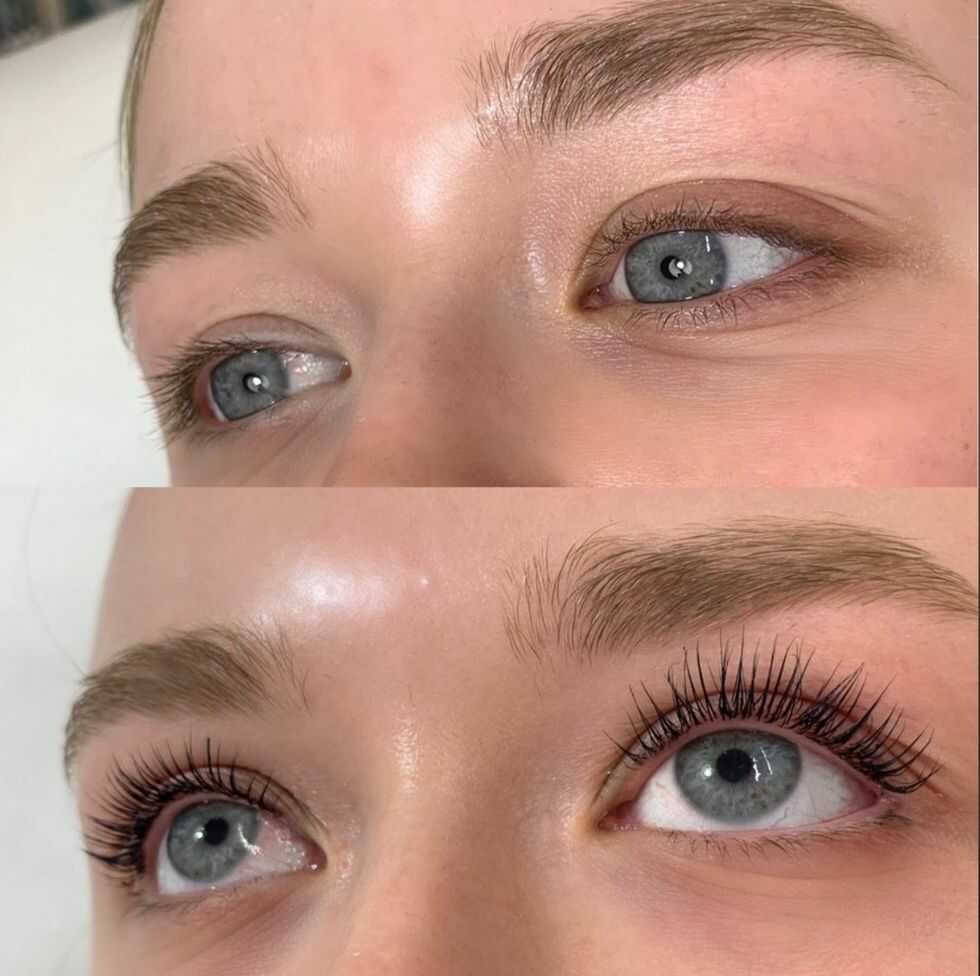 brow lift and tint before and after